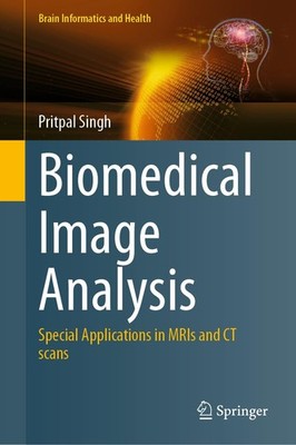 Biomedical Image Analysis: Special Applications in MRIs and CT scans (Brain Inf,