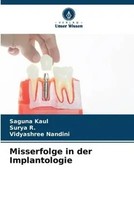 Saguna Kaul (U. A.) | Misserfolge In Der Implantologie | Taschenbuch | Deutsch