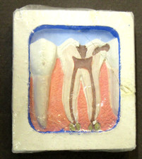 vintage #8 McKesson Robbins DISPLAY TOOTH Dentist study aid dental dentistry z5