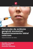 Nandita Gautam (U. A.) | CorrecçãO Da ExibiçãO Gengival Excessiva:...