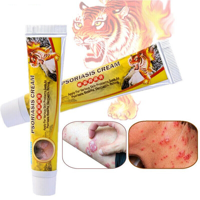 Tiger Balm Ointment Antibacterial Herbal itching Skin Treatments Psoriasis Cream