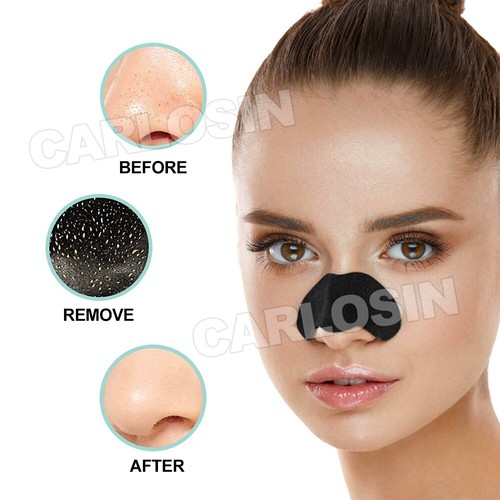UPTO 200x Blackhead Remover Nose Face Mask Strips Black Head Pore Acne Mask AU - Picture 4 of 16