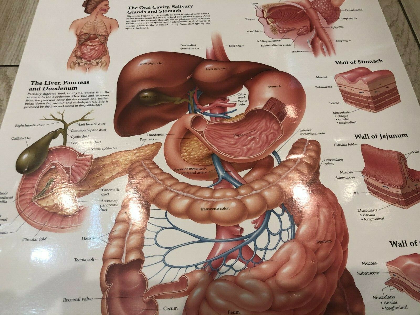 Picture 3 of 9