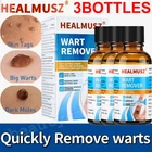 3X30ml Wart Remover Liquid Skin Tag Mole Remover Eliminate Feet Corn Wart Remove