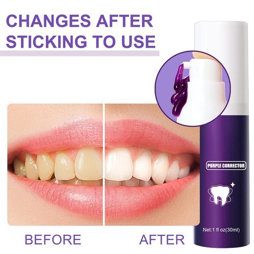 30ml Toothpaste Whitens Teeth Removes Stains for Confident Smile - Picture 6 of 7