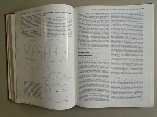 Management of Head Neck Cancer - Million Cassisi - Medizin Krebs Kopf Hals 1984 - Bild 3 von 5