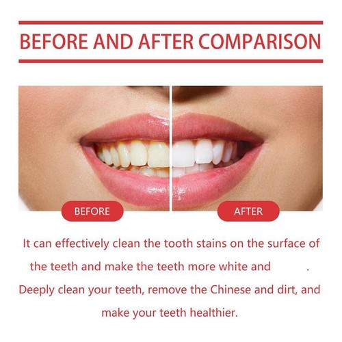 Probiotic Brightening Toothpaste, 120g Deep Cleaning Care Toothpaste Best - Picture 5 of 10