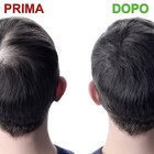 Foto 4 di 8