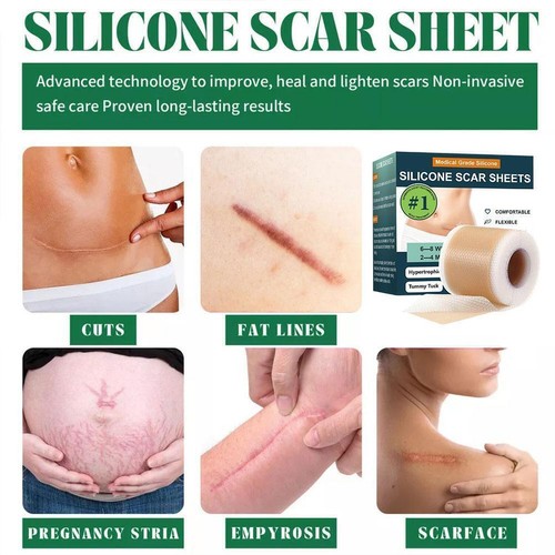 Soothing scar skin silicone scar tape scar care patch M7O1 B9M0 - Picture 6 of 10