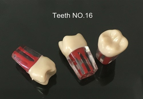 Dental Module Model Pulp Practise Root Canal File Dentist Study Student Training - Picture 5 of 8