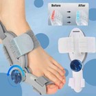 NHS Adjustable Hallux Valgus Bunion Corrector Splint Straightener Toe PainRelief