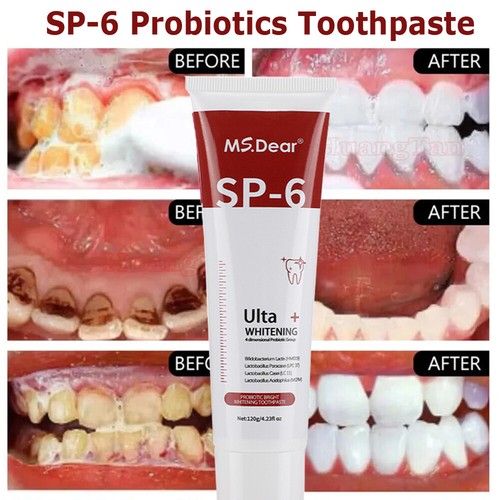 2Pack Sp-6 Probiotic Toothpaste Teeth Brightening&Bad Breath Removing Toothpaste - Picture 11 of 21