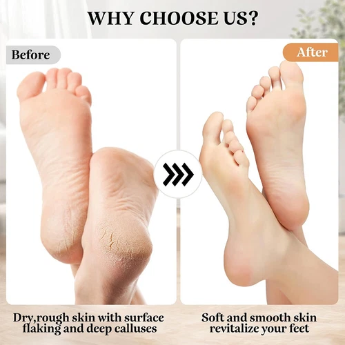 Digital Electric Foot Grinder File Callus Dead Skin Remover Pedicure Tool US - Picture 11 of 11