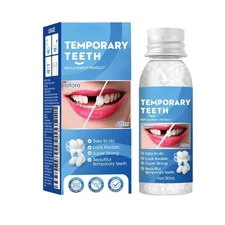 Tooth Repair Kit, Moldable Filling Dental Care Kit Fixing... 