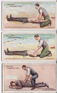 Artificial Respiration Methods Sylvester and Schafer 3 100+ Y/O Ad