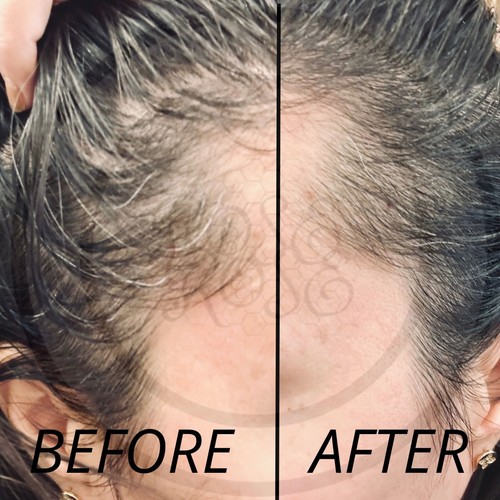 Natural Fast Hair Growth Dense Regrowth Homemade Serum Anti-Loss Treatment Spray - Picture 2 of 2