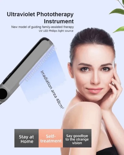 311nm UVB Phototherapy Lamp – Handheld UVB Light Device with Philips Bulb - Big - Picture 7 of 7