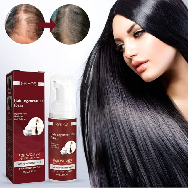 Women 5% Minoxidil Foam for Thinning Hair and Hair Loss Hair Regrowth Treatment Women 5% Minoxidil Foam for Thinning Hair and Hair Loss Hair Regrowth Treatment