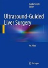 Ultrasound-Guided Liver Surgery: An Atlas by Springer Verlag (Hardback, 2014)