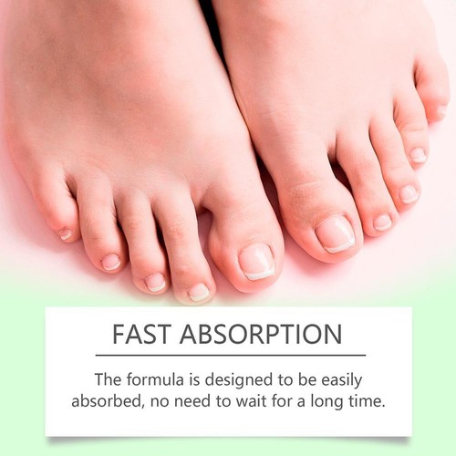 30ml Antibacterial Fungal Nail Treatment Liquid Nail Repair Essential Serum 2024 - Picture 7 of 12