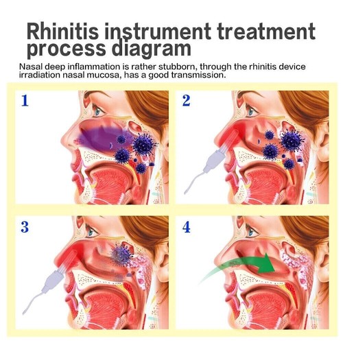 -BioNase Sinusitis Rhinitis Cure Red Light Nose Therapy Nasal Infrared Device - Picture 3 of 7