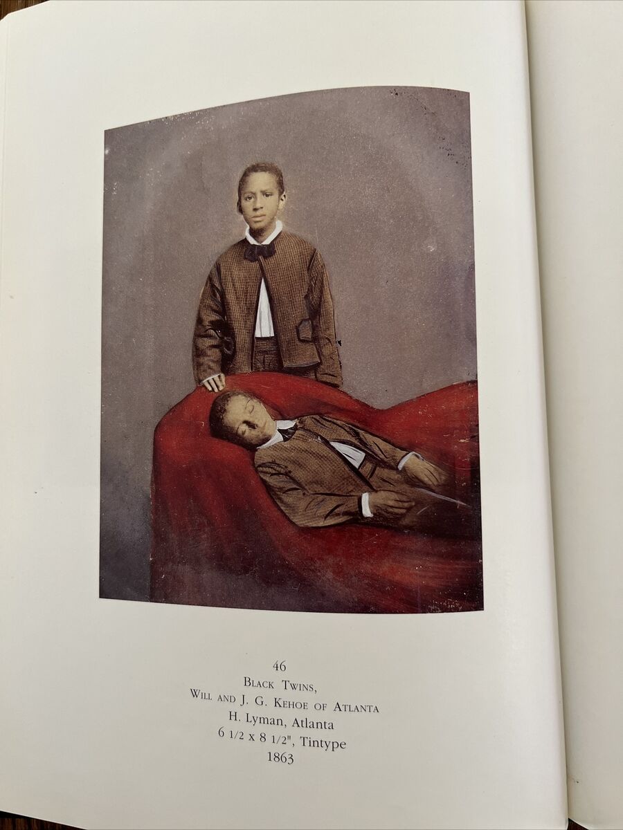 SLEEPING BEAUTY (MEMORIAL PHOTOGRAPHY) BY STANLEY BURNS ( SIGNED) 1st Editio