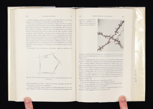 Cerebral Cortex Histonomy by S.T. Bok 1959 Neurology Brain Textbook - Picture 22 of 24