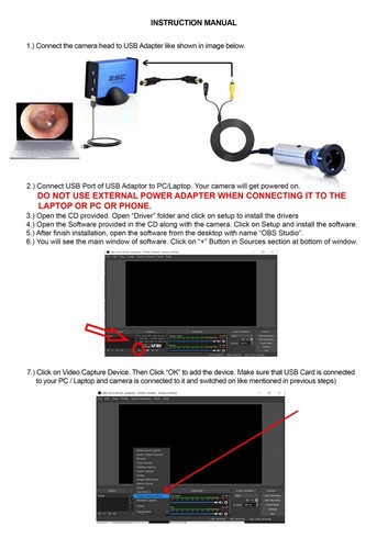Endoscopy camera HD Portable USB Rigid Endoscope ENT Medical 1.2MP Windows - Picture 8 of 14