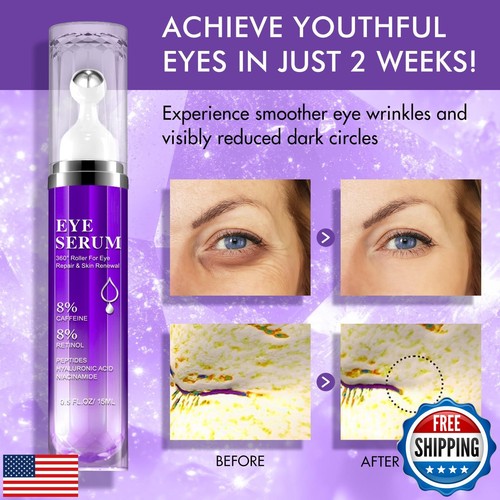 Eye Serum for Dark Circles and Puffiness, Under Eye Cream Anti Aging for Puff - Picture 4 of 5