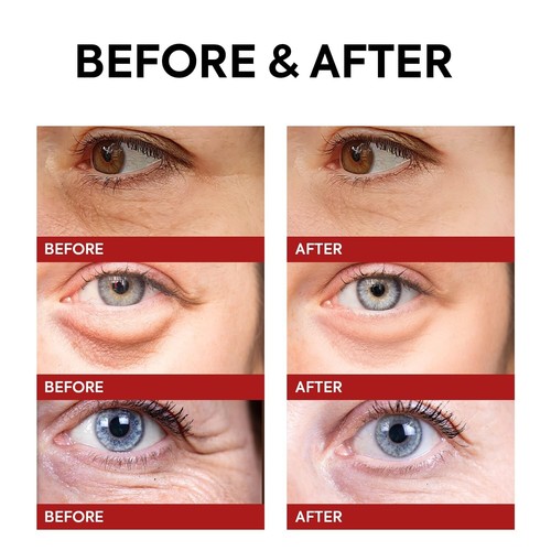 Eye Cream for Dark Circles and Puffiness, Retinol Eye Cream - Picture 6 of 9