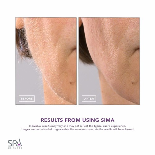 SPA SCIENCES - SIMA Patentierter Dermaplane Rasierer für Frauen Gesicht - Painless Pink - Bild 5 von 7