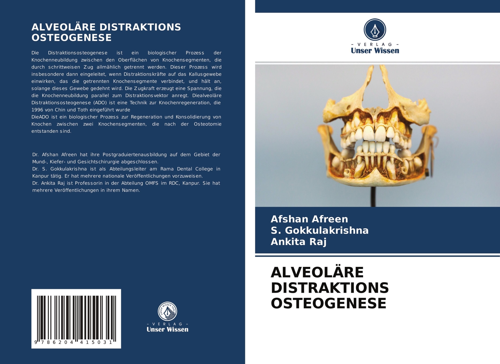 Thumbnail - Alveoläre Distraktions Osteogenese | Afshan Afreen (u. A.) | Deutsch |