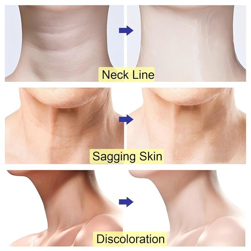 Pure Neck Firming Cream, Anti-Aging Tighten & Lift Neck Cream, Chest Neck Skin C - Picture 7 of 24