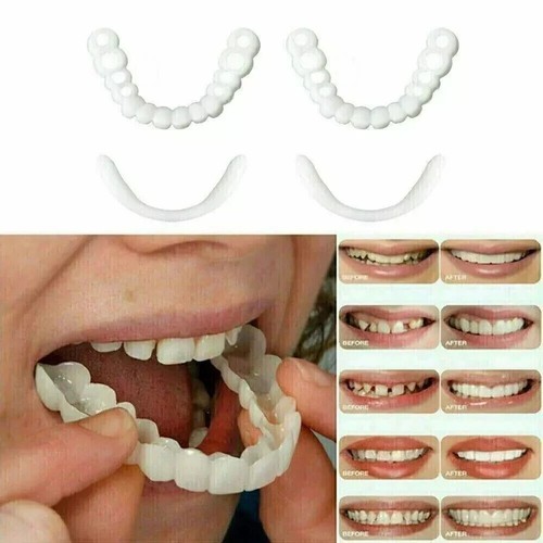Juego de cubierta de dientes dentales carillas dentales inferiores superiores dientes postizos a presión - Imagen 3 de 24