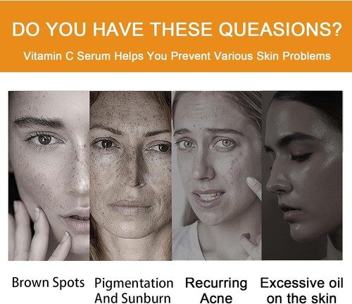 Vitamin C Face Lift Serum SOLUTION Hyaluronic Acid For Micro Needle Derma Roller - Picture 2 of 7