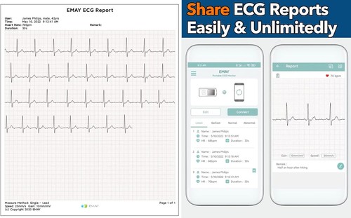 Portable Stand-Alone ECG Heart Rate Monitor - No Subscription - LCD Screen - Picture 5 of 7