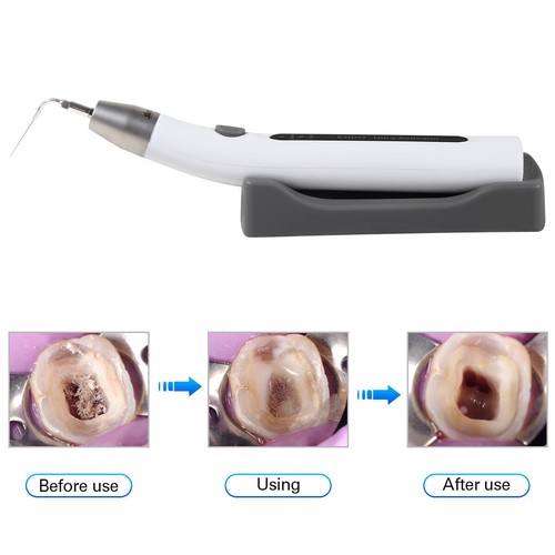 Ultrasonic Dental LED Endo Ultra Activator Irrigator Root Canal Scaling Tip - Picture 3 of 14