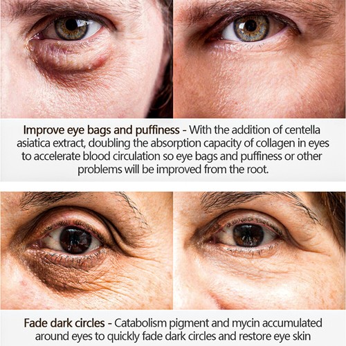 Magic Eye Cream-28 Seconds Instant Remove Eye Bags&dark Circles&eye Wrinkles 20g - Picture 6 of 24
