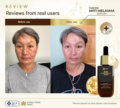 2X Yanhee Anti-Melasma Serum Reduce Dark Spot Brightening Skin 30 ml - Picture 4 of 6