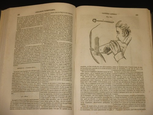 VELPEAU Nouveaux Elements de Medecine Operatoire 1840 5th Ed French Surgery - Imagen 9 de 10