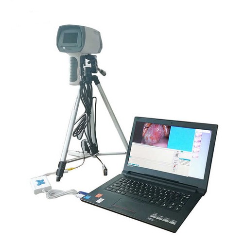 800K Pixel Colposcope SONY Vaginal Color Camera Video Zoom Tripod & Pedal - Bild 5 von 6