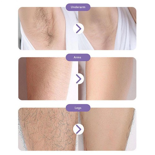 Painless Physical Hair Removal Epilators Crystal Eraser Tool For Body Arm Unisex - Picture 5 of 15
