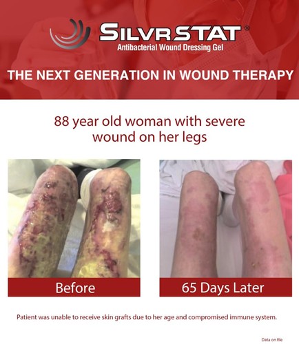 First Aid Kit Gel | 32 PPM Silver Healing Wound Dressing Gel | SilverSol Ag₄O... - Picture 7 of 9