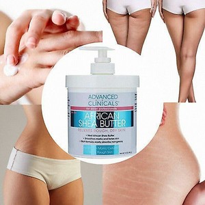 Para estrias crema