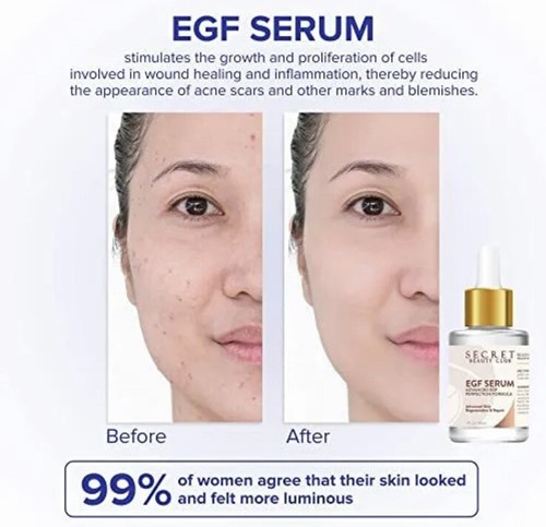 EGF Serum – Wrinkle Serum and Rapid Wrinkle Repair Scar Reducing Acne Scar Treat - Picture 6 of 7