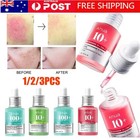 ANUA Niacinamide 10% + TXA Tranexamic Acid 4% Dark Spot Correcting Serum 30mL AU