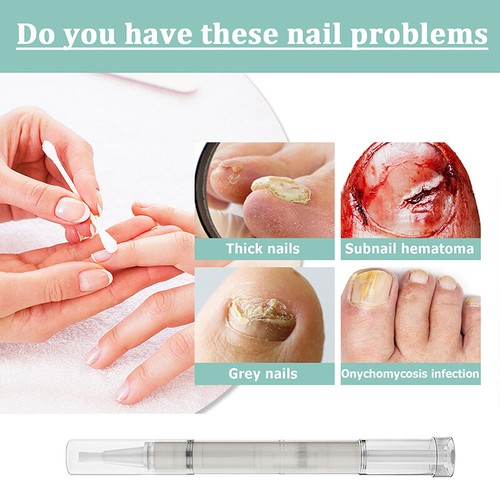Lápiz de aceite reparador suero de uñas cuidado de uñas cuidado de hongos tratamiento de uñas ❆ ≌ - Imagen 6 de 14