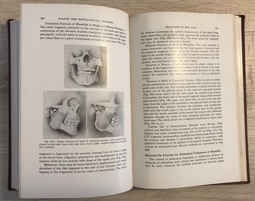 Manual of Standard Practice of Plastic and Maxillofacial Surgery, Saunders 1943 - Picture 12 of 12