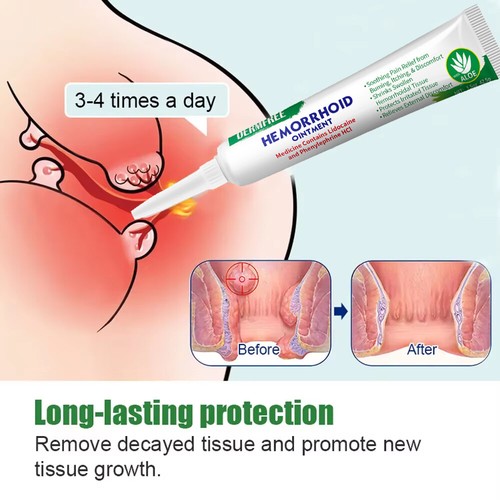 Hemorrhoids Removes Ointment Herbal Cream Rapid Relief Piles Pain Reduce Itching - Picture 9 of 26