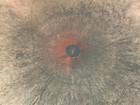 Foto 10 di 12